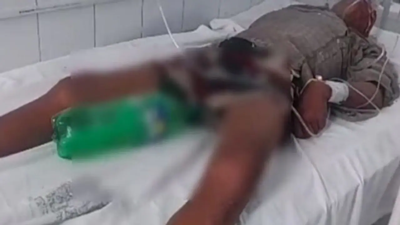 சிறுநீர் பைக்கு பதிலாக ஸ்ப்ரைட் பாட்டில்: அரசு மருத்துவமனையின் அவலம்!