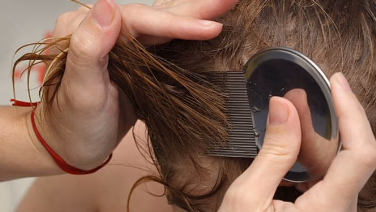 മകളുടെ തലയിലെ പേനിനെ കൊല്ലാറില്ല; കാരണം വെളിപ്പെടുത്തിയ അമ്മയ്ക്ക് ട്രോള്‍...