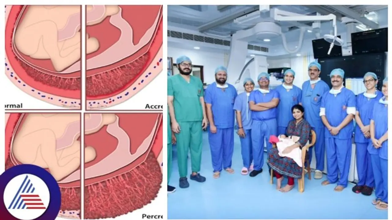 ಕರ್ನಾಟಕದಲ್ಲೇ ಮೊದಲು, ಮಣಿಪಾಲ ಕೆಎಂಸಿ ಆಸ್ಪತ್ರೆಯಲ್ಲಿ ಅಪರೂಪದ ಶಸ್ತ್ರಚಿಕಿತ್ಸೆ ಕರ್ನಾಟಕದಲ್ಲೇ ಮೊದಲು, ಮಣಿಪಾಲ ಕೆಎಂಸಿ ಆಸ್ಪತ್ರೆಯಲ್ಲಿ ಅಪರೂಪದ ಶಸ್ತ್ರಚಿಕಿತ್ಸೆ