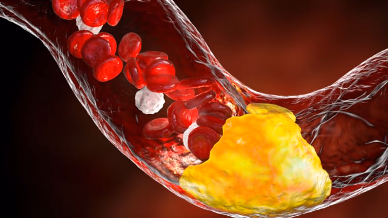  കൊളസ്ട്രോൾ നിയന്ത്രിക്കാൻ സഹായിക്കുന്ന അഞ്ച് പഴങ്ങൾ 