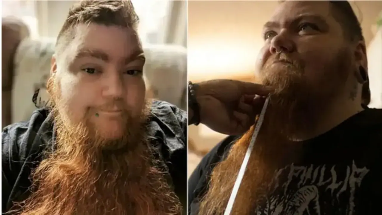WATCH: US woman with PCOS shatters Guinness World Record for longest female beard