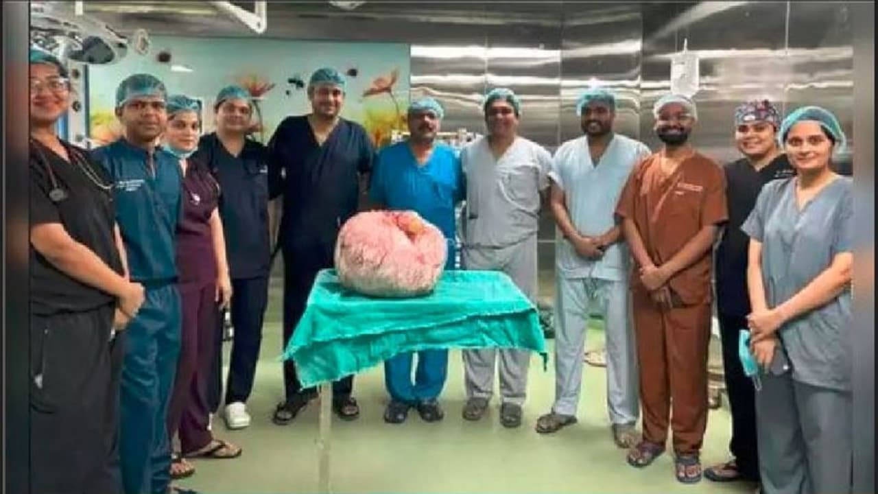 ಒಂದಲ್ಲ ಎರಡಲ್ಲ, ಮಹಿಳೆಯ ಹೊಟ್ಟೆಯಲ್ಲಿದ್ದ ಬರೋಬ್ಬರಿ 15 ಕೆಜಿ ಗಡ್ಡೆ ಹೊರತೆಗೆದ ವೈದ್ಯರು ಒಂದಲ್ಲ ಎರಡಲ್ಲ, ಮಹಿಳೆಯ ಹೊಟ್ಟೆಯಲ್ಲಿದ್ದ ಬರೋಬ್ಬರಿ 15 ಕೆಜಿ ಗಡ್ಡೆ ಹೊರತೆಗೆದ ವೈದ್ಯರು