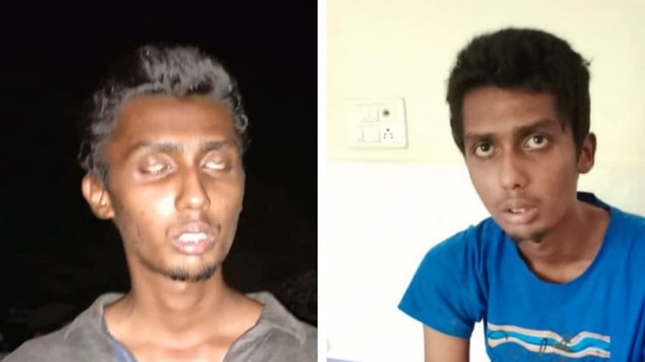 ಉಡುಪಿ: ಮಾದಕ ವ್ಯಸನಿ ಯುವಕನಿಗೆ ಬೇಕಿದೆ ಸಮಾಜದ ಆಶ್ರಯ ! ಉಡುಪಿ: ಮಾದಕ ವ್ಯಸನಿ ಯುವಕನಿಗೆ ಬೇಕಿದೆ ಸಮಾಜದ ಆಶ್ರಯ !