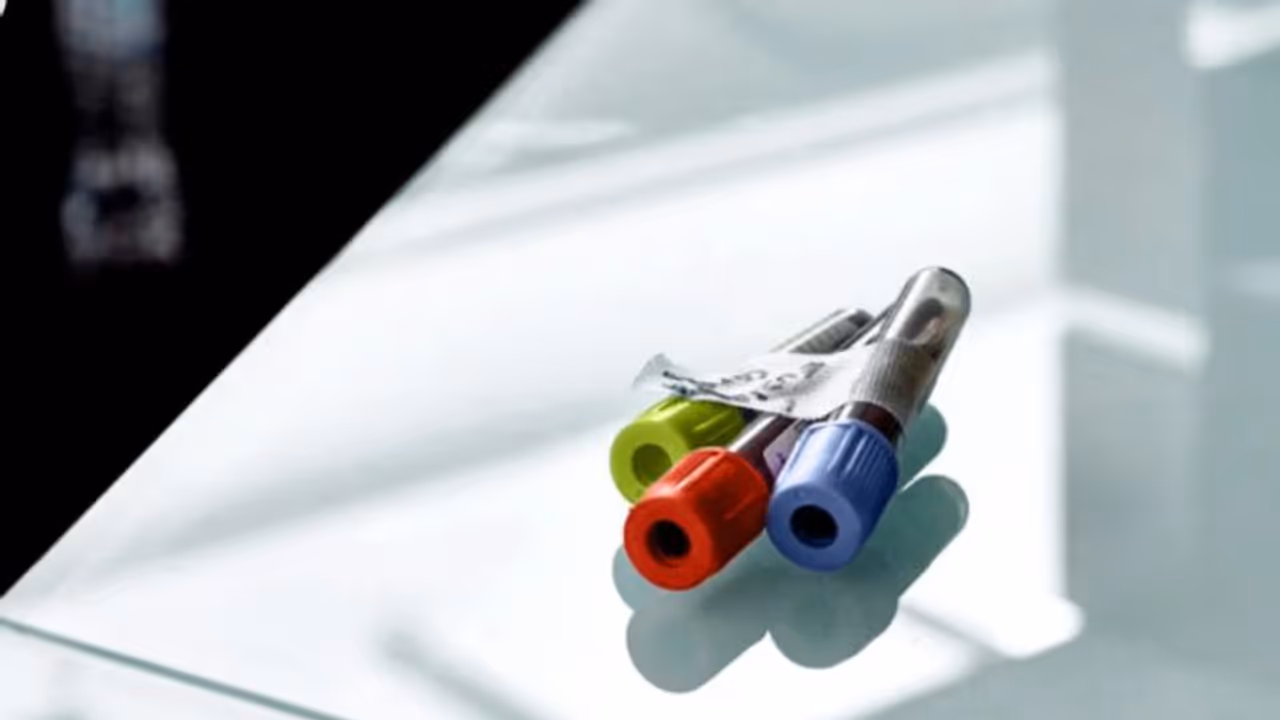  ശ്വാസകോശാര്‍ബുദ സാധ്യത നേരത്തെ പ്രവചിക്കാന്‍ കഴിയുന്ന രക്തപരിശോധന വികസിപ്പിച്ച് ഗവേഷകര്‍ 