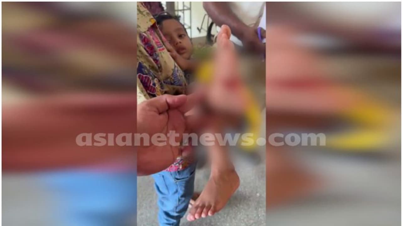 ഗുരുവായൂരിൽ ക്ഷേത്ര ദർശനത്തിനെത്തിയ 4 വയസ്സുകാരനെ തെരുവുനായകൾ ആക്രമിച്ചു 