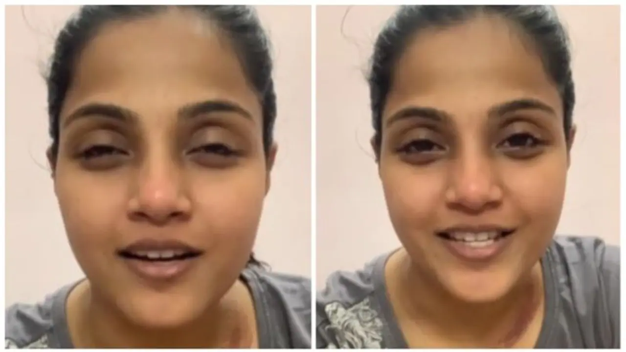 விபத்தில் சிக்கிய விஜய் டிவி சீரியல் நடிகை..! சீட் பெல்ட் போட்டதால் தப்பித்தேன்! காயங்களுடன் வெளியிட்ட வீடியோ!