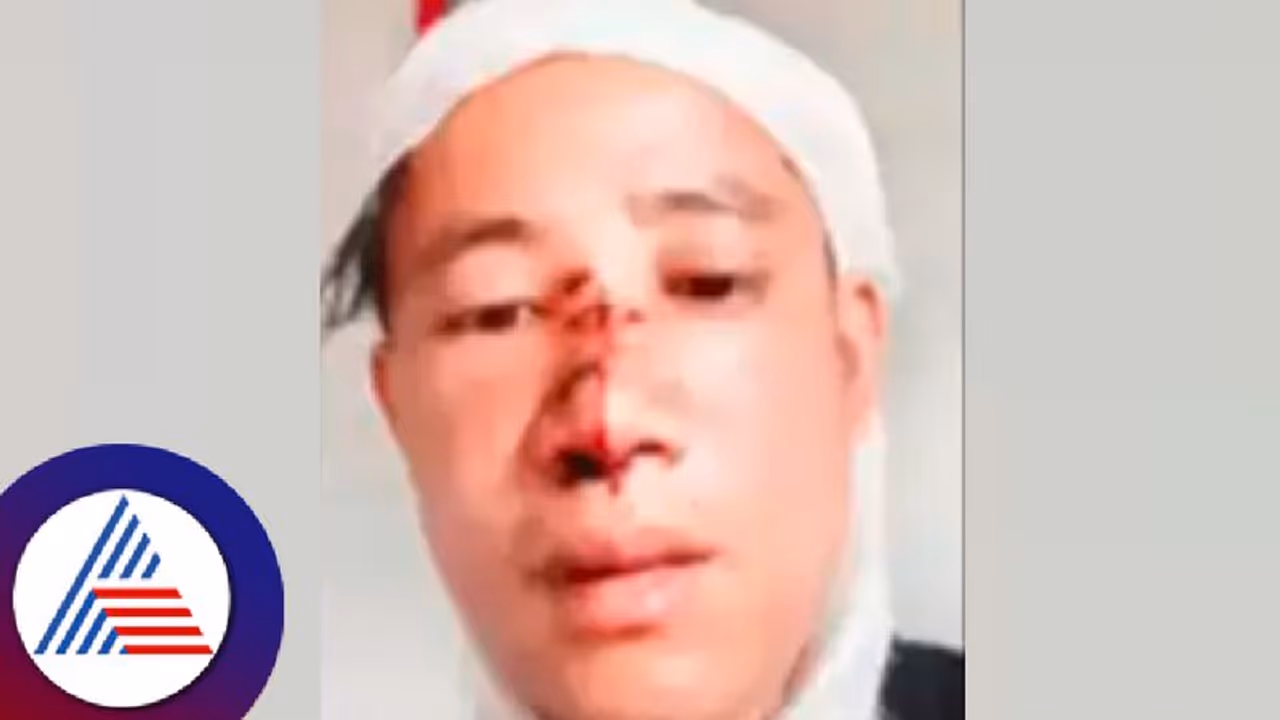 Fake news ಸಿಕ್ಕಿಂ ಮೂಲದ ವ್ಯಕ್ತಿಗೆ ಚೈನೀಸ್ ಎಂದು ಹಲ್ಲೆ ಆರೋಪ ಸುಳ್ಳು ಸುದ್ದಿ Fake news ಸಿಕ್ಕಿಂ ಮೂಲದ ವ್ಯಕ್ತಿಗೆ ಚೈನೀಸ್ ಎಂದು ಹಲ್ಲೆ ಆರೋಪ ಸುಳ್ಳು ಸುದ್ದಿ