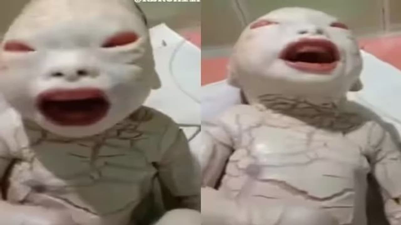 Viral Video: दुनिया में जन्मा 'एलियन', डॉक्टर के उड़े होश 