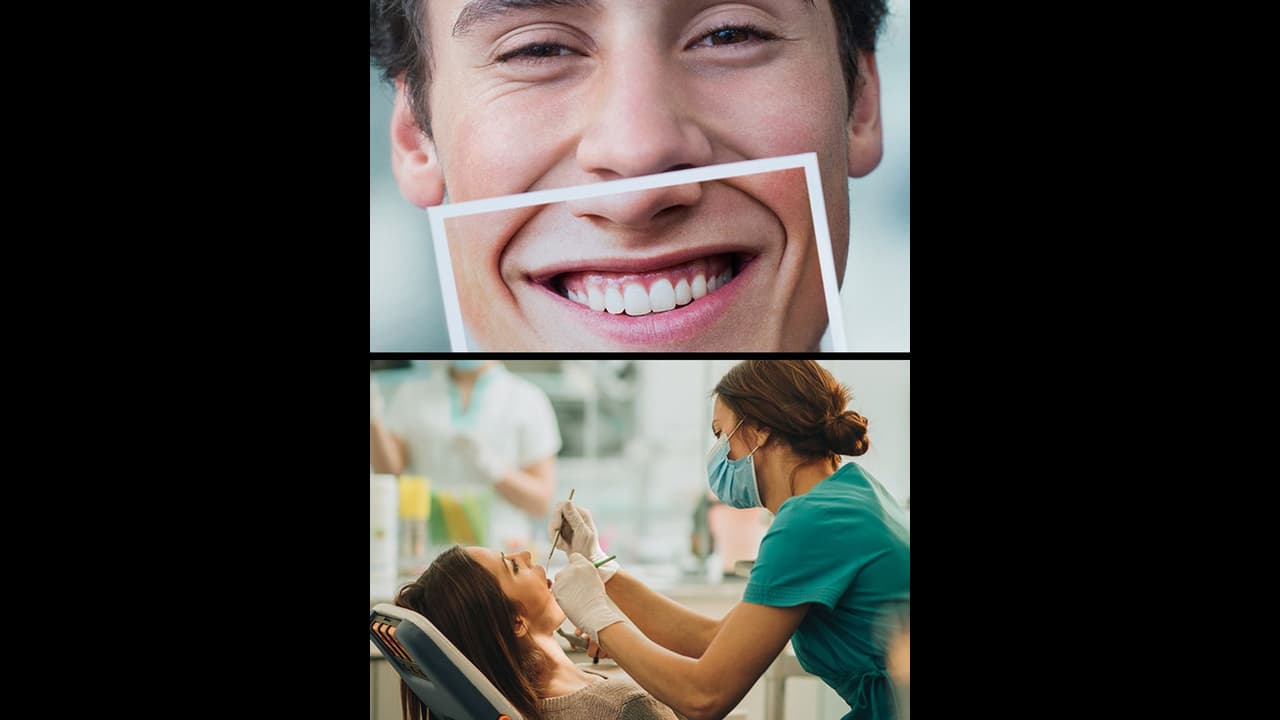 ಹಲ್ಲಿನ ಬಗ್ಗೆ ನಿಮಗೂ ಭಯ ಇದ್ಯಾ? ಕಾಡ್ತಿರಬಹುದು ಡೆಂಟಲ್ ಎಂಕ್ಸೈಟಿ