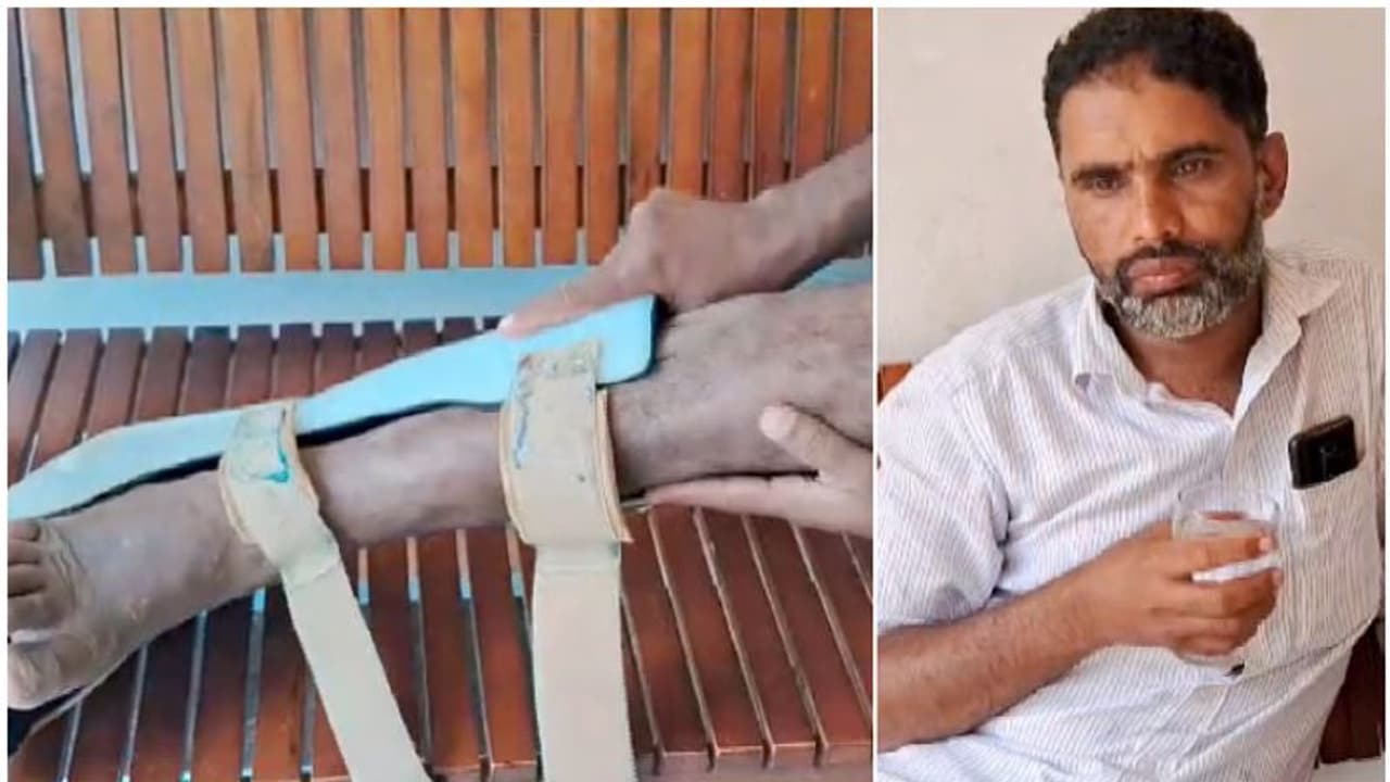 നടന്ന് എത്തി, കാലിലെ ഞരമ്പ് മാറി ശസ്ത്രക്രിയ; പിന്നെ നടത്തിയത് 11 ശസ്ത്രക്രിയകള്, ചലനശേഷി നഷ്ടപ്പെട്ട് യുവാവ് നടന്ന് എത്തി, കാലിലെ ഞരമ്പ് മാറി ശസ്ത്രക്രിയ; പിന്നെ നടത്തിയത് 11 ശസ്ത്രക്രിയകള്, ചലനശേഷി നഷ്ടപ്പെട്ട് യുവാവ്