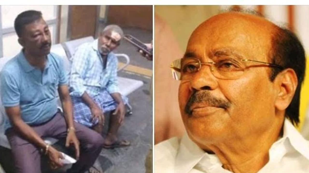 காவல் அதிகாரியை மது போதையில் கொடூரமாக தாக்கிய சிறுவர்கள்..! எங்கே போகிறது தமிழ்நாடு? ராமதாஸ் வேதனை காவல் அதிகாரியை மது போதையில் கொடூரமாக தாக்கிய சிறுவர்கள்..! எங்கே போகிறது தமிழ்நாடு? ராமதாஸ் வேதனை