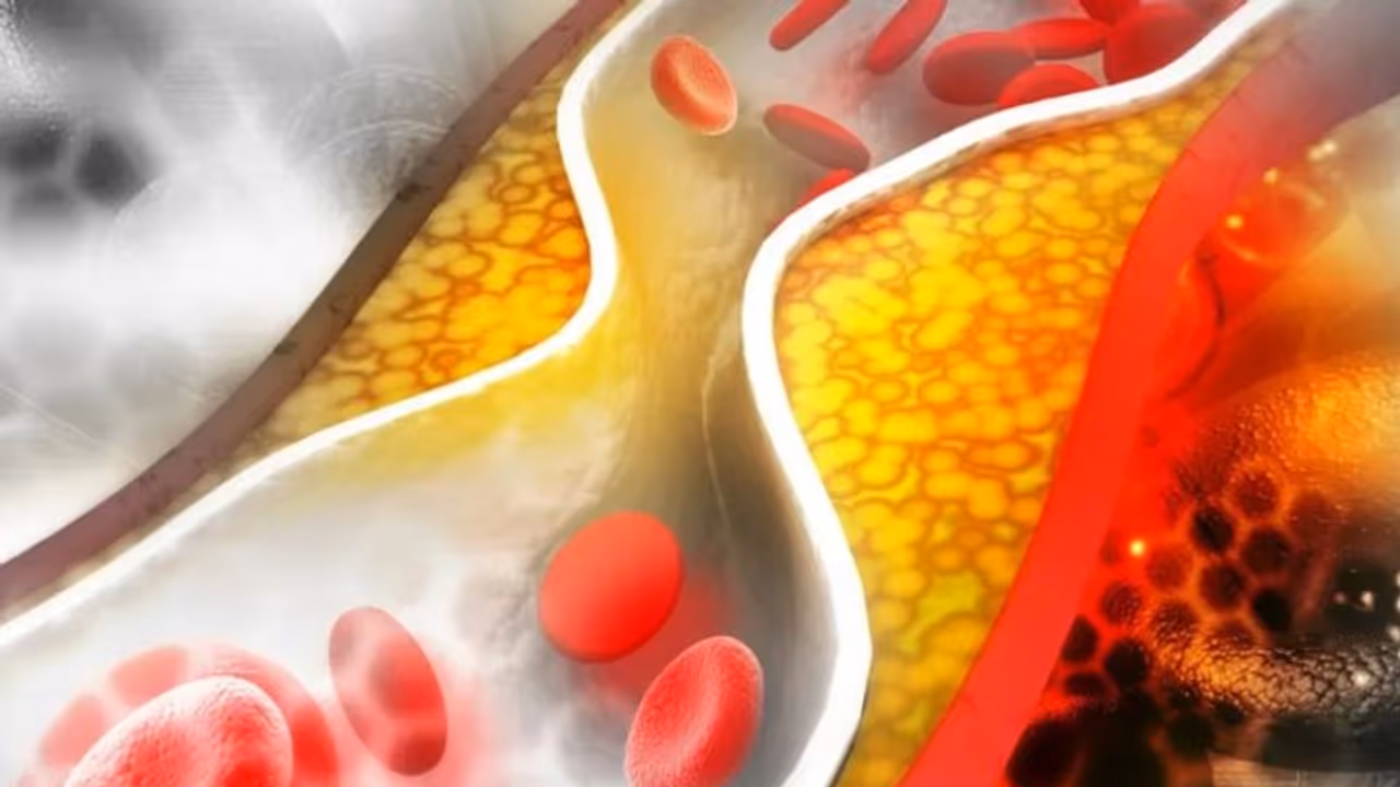 30 की उम्र में कितना कोलेस्ट्रॉल है सेहतमंद और कितना है खतरे की घंटी? 30 की उम्र में कितना कोलेस्ट्रॉल है सेहतमंद और कितना है खतरे की घंटी?