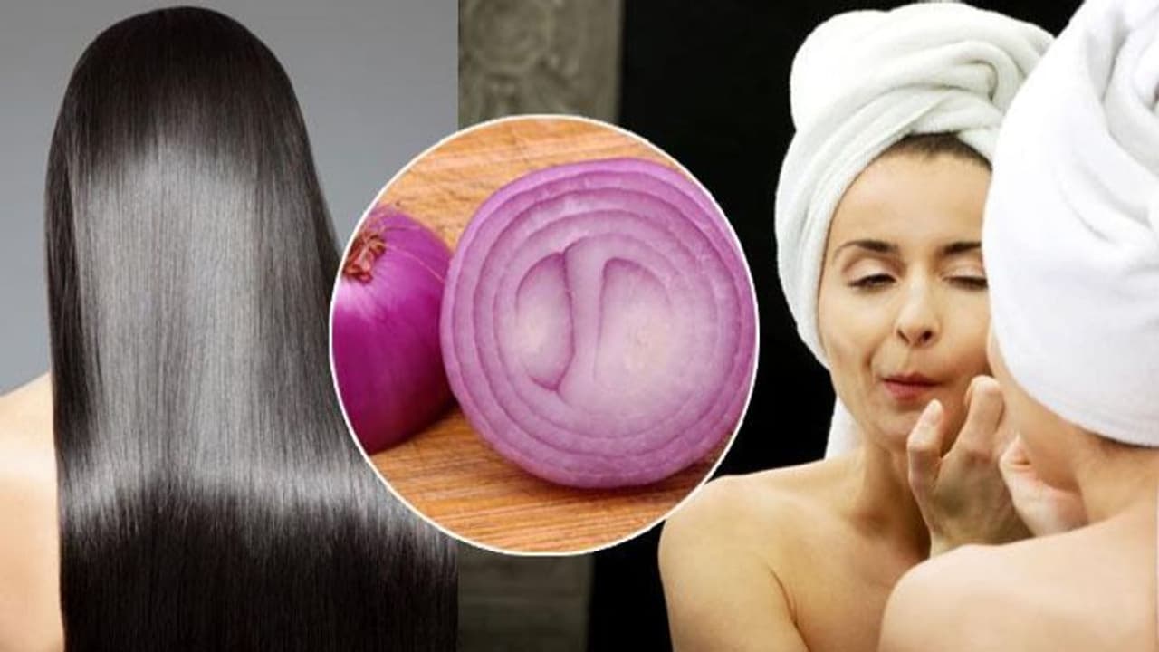 മുഖത്തും തലമുടിയിലും ഉള്ളി ഇങ്ങനെ ഉപയോഗിക്കാം; അറിയാം ഗുണങ്ങള്‍... 