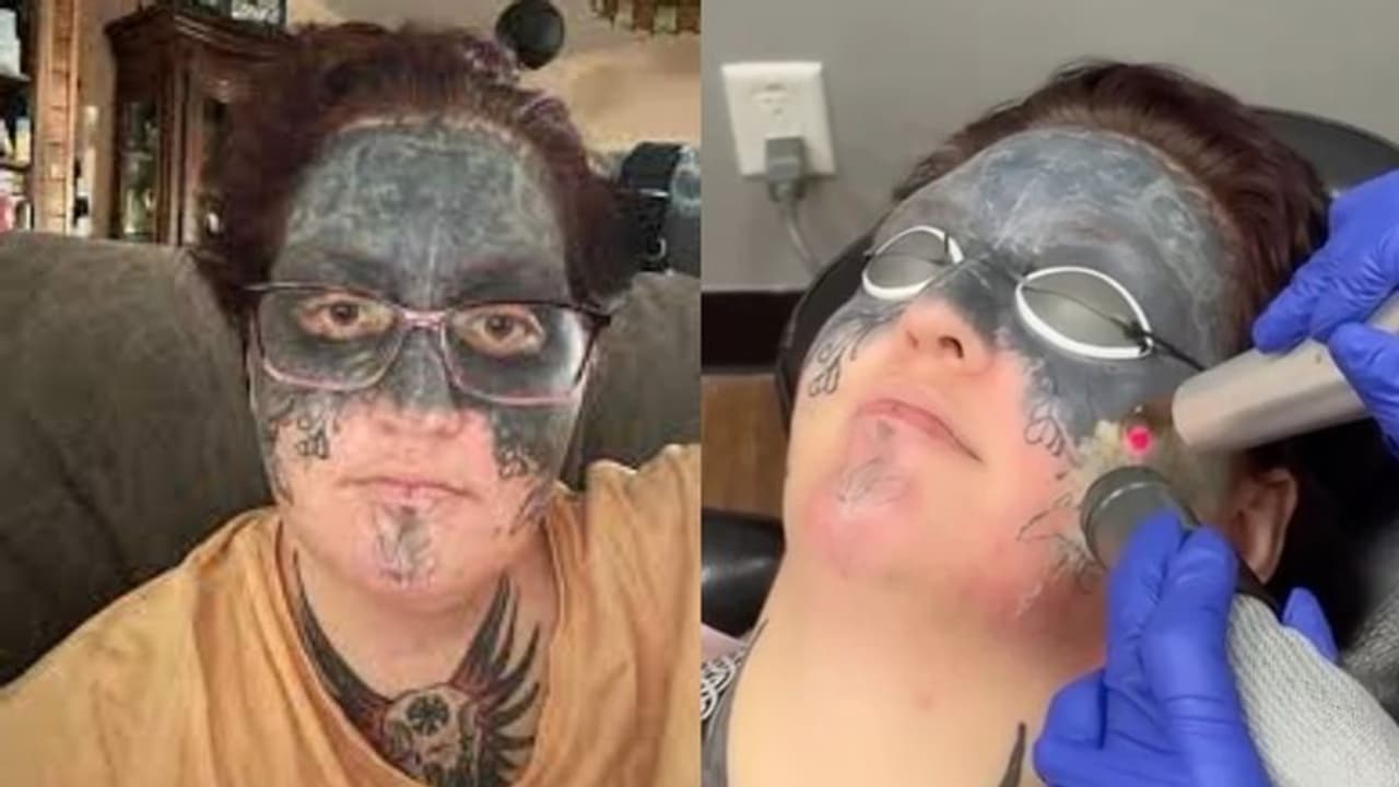 ലഹരിക്ക് അടിപ്പെടുത്തി കാമുകൻ മുഖത്ത് ചെയ്ത ടാറ്റൂ; ഒടുവില്‍ യുവതിക്ക് ആശ്വാസം