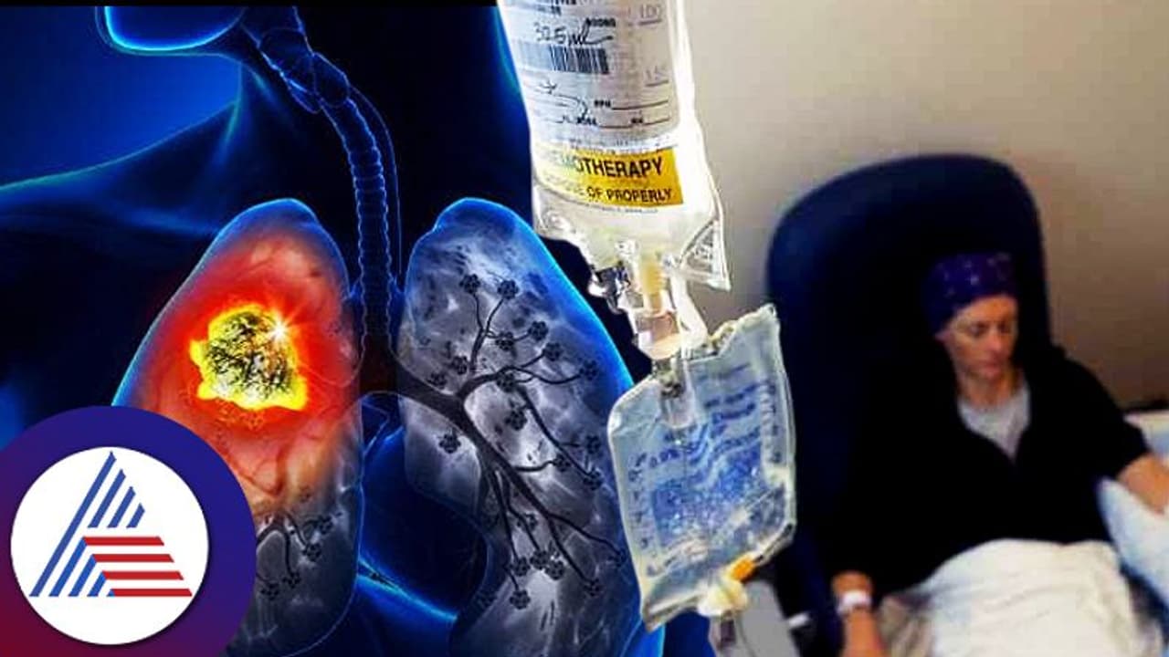 ಶ್ರೀಮಂತರನ್ನೇ ಹೆಚ್ಚಾಗಿ ಕಾಡುತ್ತೆ ಈ ಚರ್ಮದ ಕ್ಯಾನ್ಸರ್, ಏಕೋ? 