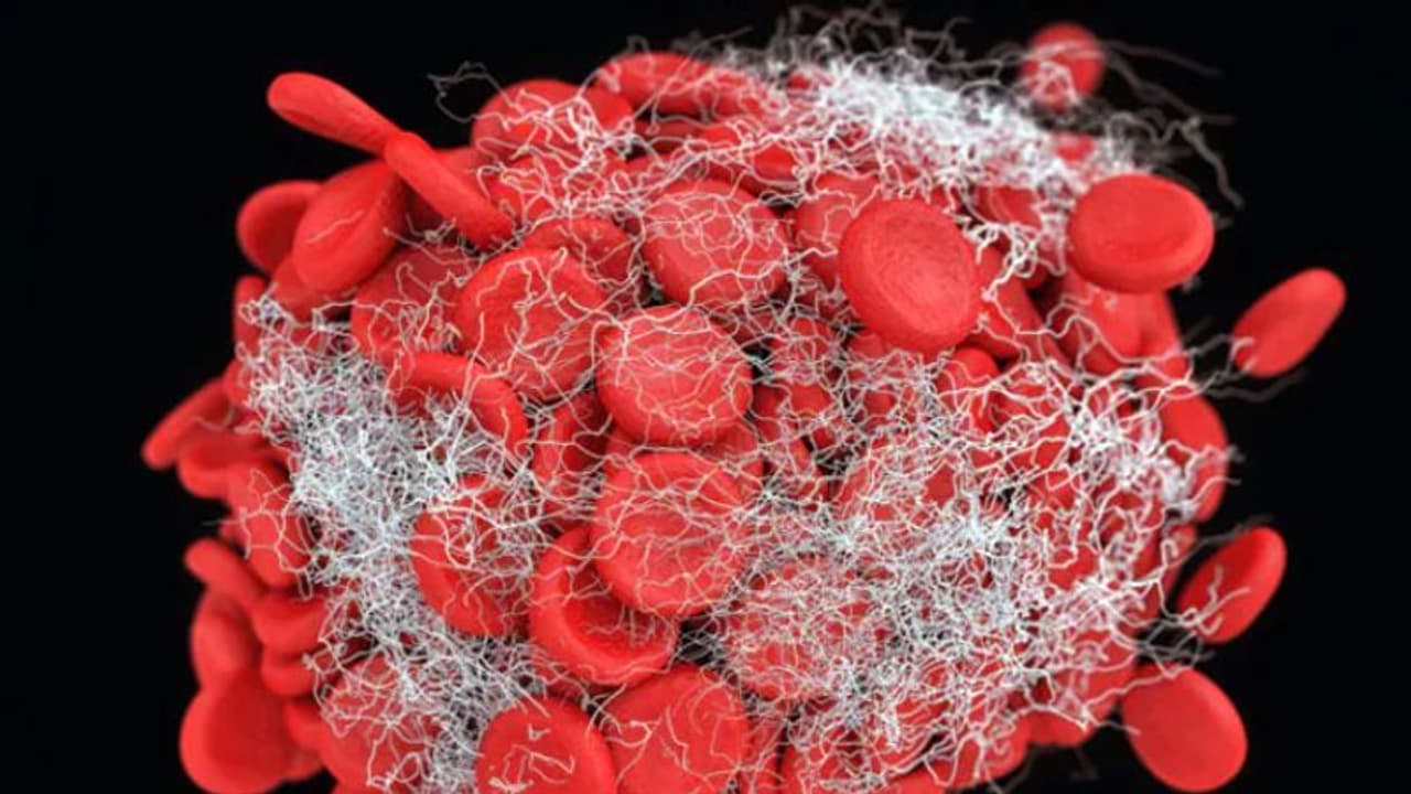 ലുക്കീമിയ; ഈ ലക്ഷണങ്ങൾ നിസാരമായി കാണരുത്... 