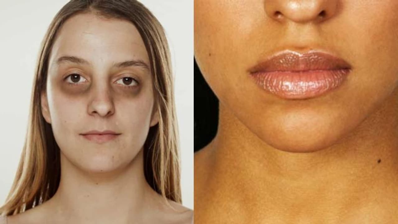 കൺതടങ്ങളിലെയും കഴുത്തിലെയും ചുണ്ടുകളിലെയും ഇരുണ്ട നിറം; ഈ രണ്ട് പച്ചക്കറികള്‍ ഇങ്ങനെ ഉപയോഗിക്കാം...