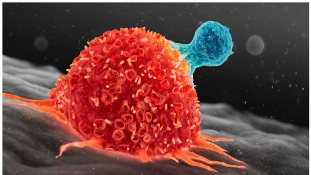 കാൻസർ ഉണ്ടാകുന്നതിന് പിന്നിലെ 10 പ്രധാനപ്പെട്ട കാരണങ്ങൾ കാൻസർ ഉണ്ടാകുന്നതിന് പിന്നിലെ 10 പ്രധാനപ്പെട്ട കാരണങ്ങൾ