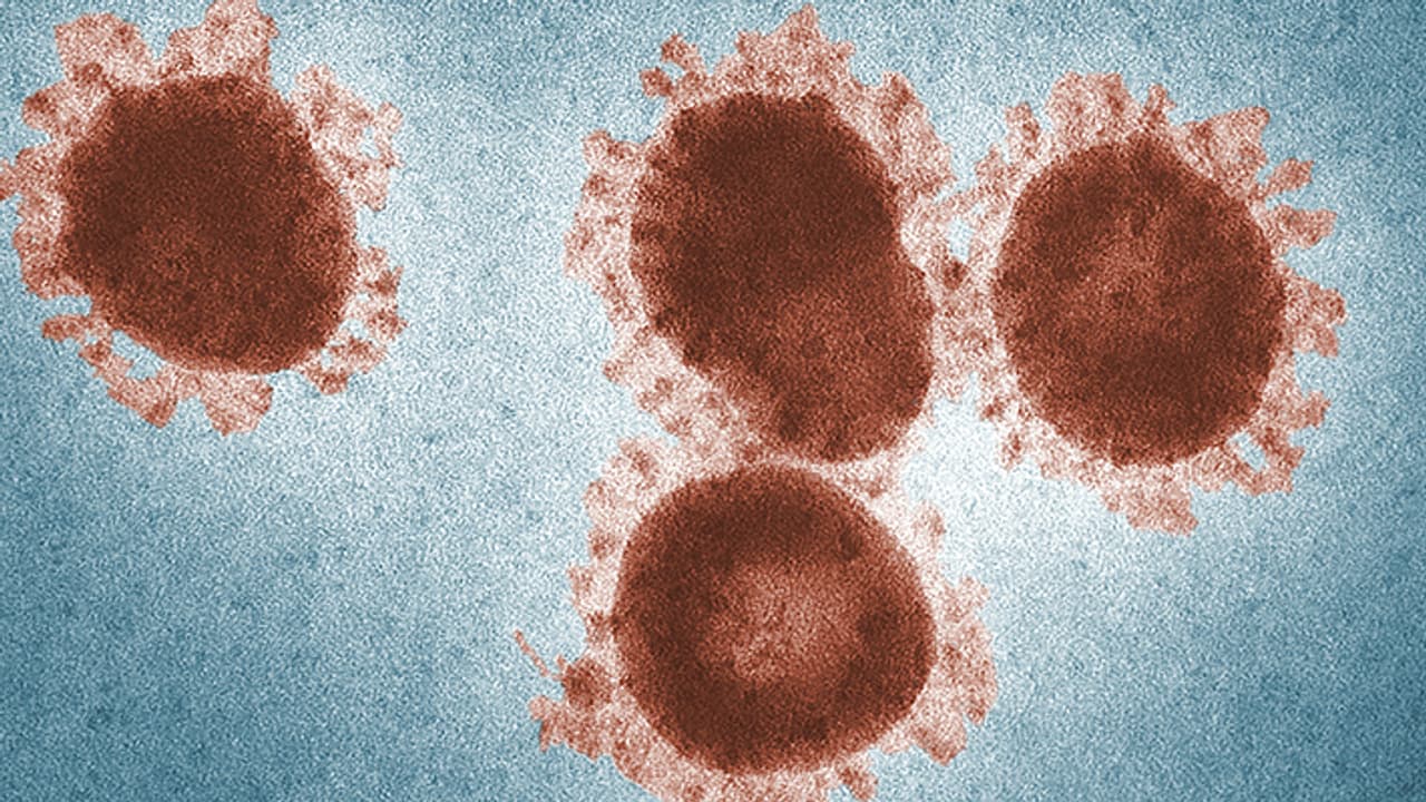 nipah virus symptoms nipah virus symptoms