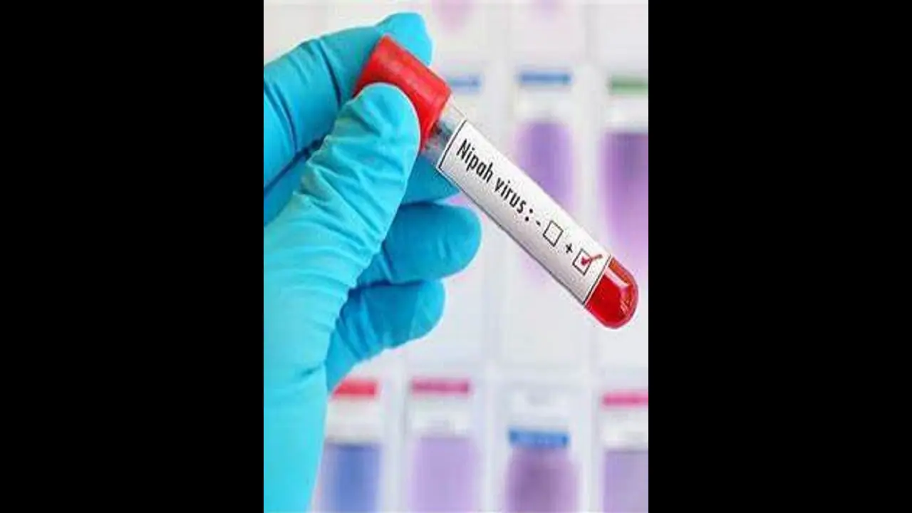 Nipah virus: Dental student admitted in Thiruvananthapuram tests negative Nipah virus: Dental student admitted in Thiruvananthapuram tests negative