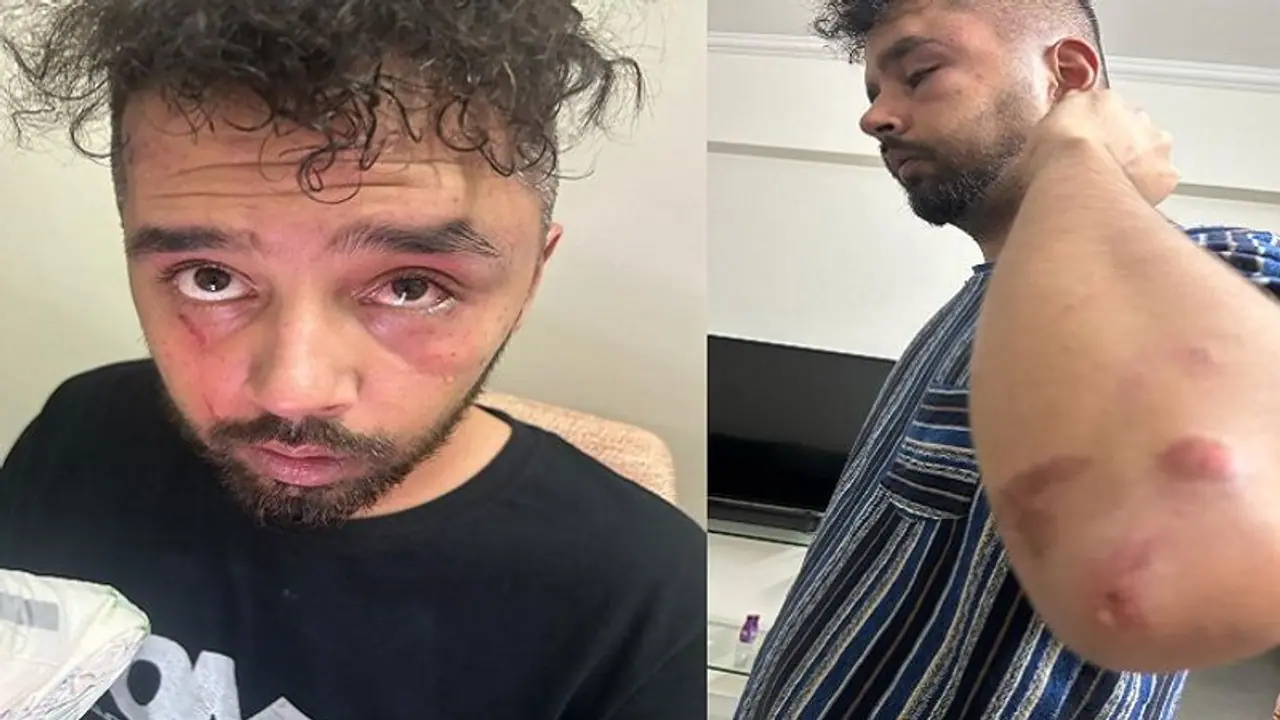 పబ్ లో యువతి విషయంలో గొడవ.. యువకుడిని చితకబాదిన మాజీ డీజీపీ గౌతమ్ సవాంగ్ కుమారుడు... పబ్ లో యువతి విషయంలో గొడవ.. యువకుడిని చితకబాదిన మాజీ డీజీపీ గౌతమ్ సవాంగ్ కుమారుడు...