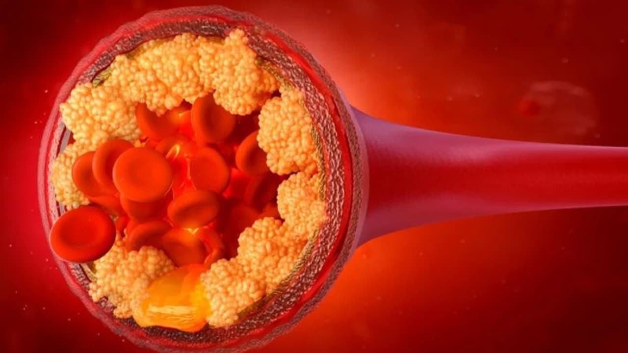 ചീത്ത കൊളസ്ട്രോളിനെ കുറയ്ക്കാന്‍ ഡയറ്റില്‍ ഉള്‍പ്പെടുത്തേണ്ട നാല് പച്ചക്കറികള്‍... 