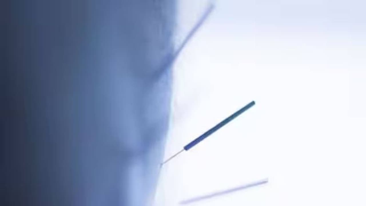 അമ്മയോടൊപ്പം ജോലിസ്ഥലത്തെത്തിയ കുട്ടി വിഴുങ്ങിയത് എട്ട് സൂചികൾ!