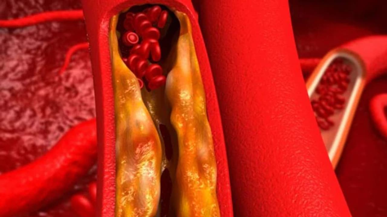 കൊളസ്ട്രോളിനെ എങ്ങനെ നിയന്ത്രിക്കാം? തിരിച്ചറിയണം ഈ അപകടസാധ്യതകൾ... കൊളസ്ട്രോളിനെ എങ്ങനെ നിയന്ത്രിക്കാം? തിരിച്ചറിയണം ഈ അപകടസാധ്യതകൾ...