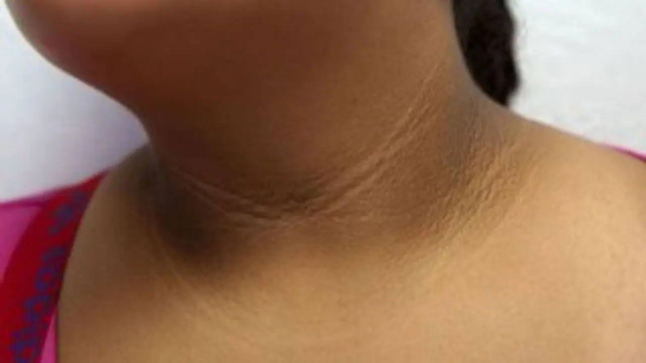 കഴുത്തിലെ ഇരുണ്ട പാടുകള്‍ അകറ്റാം; വീട്ടില്‍ പരീക്ഷിക്കാം ഇക്കാര്യങ്ങള്‍...