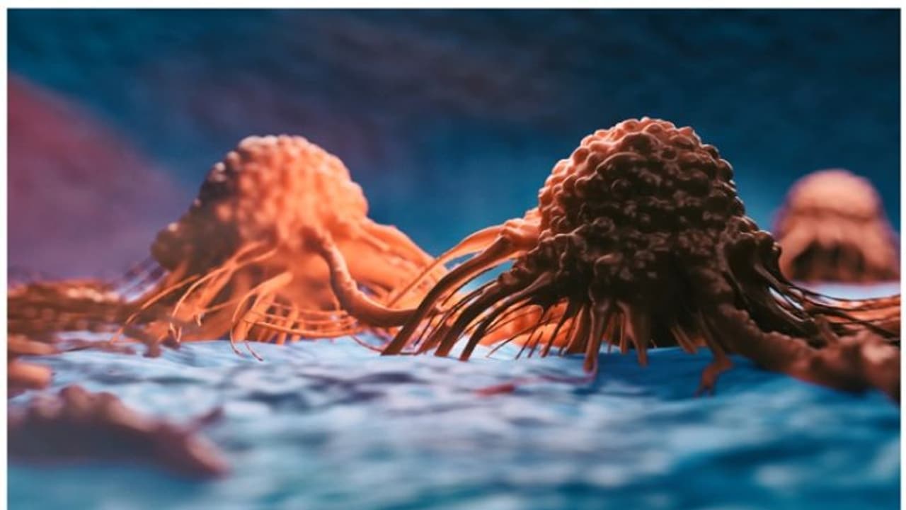 പുകവലിക്കാത്തവരിൽ ശ്വാസകോശ കാൻസർ ഉണ്ടാകുന്നതിന് പിന്നിലെ 5 കാരണങ്ങൾ പുകവലിക്കാത്തവരിൽ ശ്വാസകോശ കാൻസർ ഉണ്ടാകുന്നതിന് പിന്നിലെ 5 കാരണങ്ങൾ