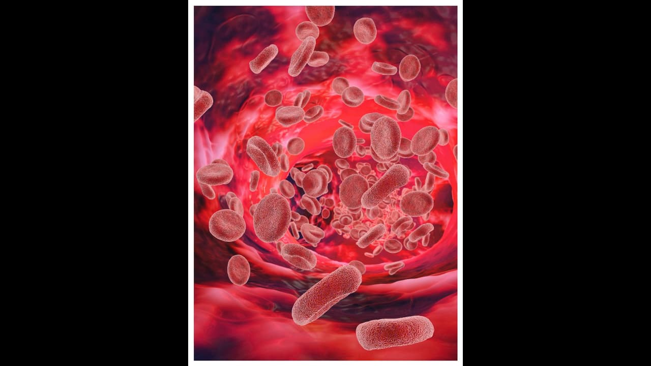 വിളർച്ച അകറ്റാൻ ഭക്ഷണത്തിൽ ശ്രദ്ധിക്കേണ്ടത് എന്തൊക്കെ? വിളർച്ച അകറ്റാൻ ഭക്ഷണത്തിൽ ശ്രദ്ധിക്കേണ്ടത് എന്തൊക്കെ?