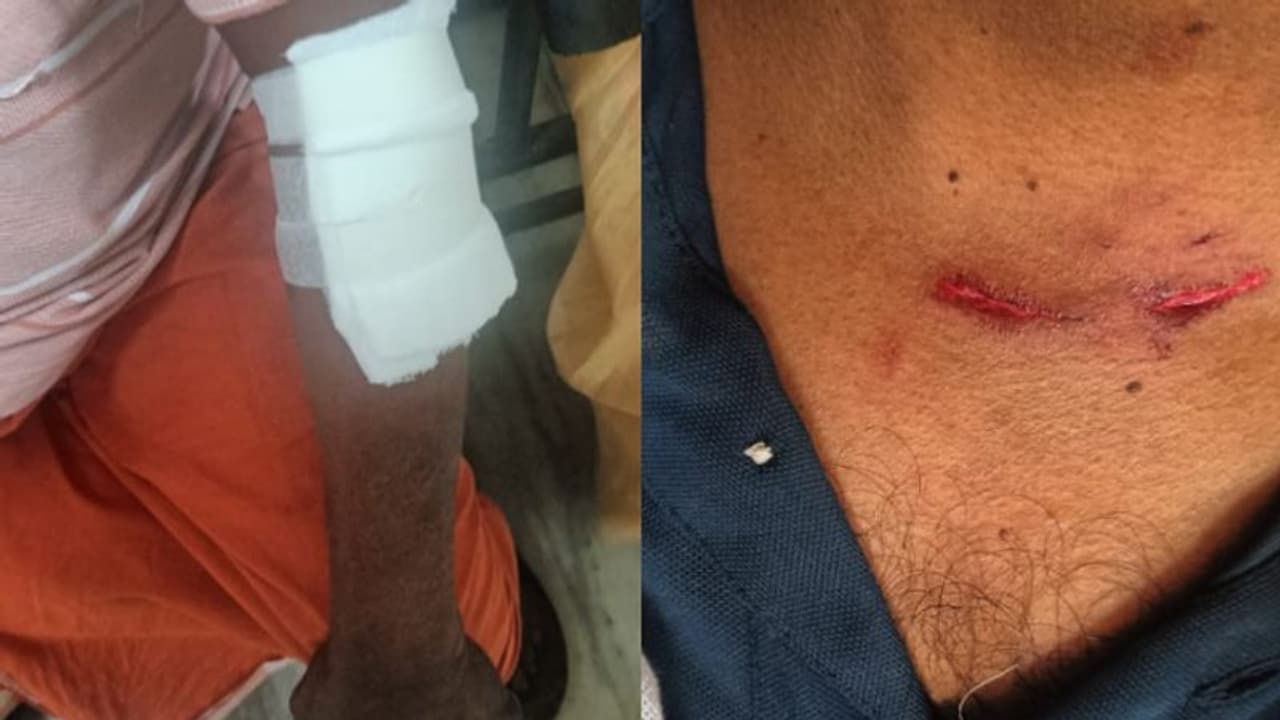 കൈയിലും കഴുത്തിലും കാലിലും കടിച്ചു, മാന്നാറില് തെരുവുനായ് ആക്രമണത്തില് മൂന്നുപേര്ക്ക് ഗുരുതര പരിക്ക് കൈയിലും കഴുത്തിലും കാലിലും കടിച്ചു, മാന്നാറില് തെരുവുനായ് ആക്രമണത്തില് മൂന്നുപേര്ക്ക് ഗുരുതര പരിക്ക്