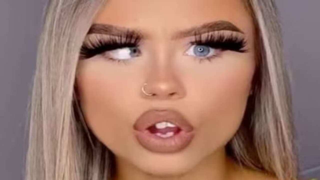 കോങ്കണ്ണുള്ള മോഡൽ കണ്ണുകൾ ഉപയോഗിച്ച് സമ്പാദിച്ചത് മൂന്നുകോടി; ശസ്ത്രക്രിയയിലൂടെ കണ്ണുകൾ നേരെയാക്കാൻ ശ്രമം