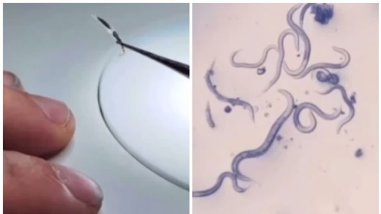 ടെന്‍ഷന്‍ വരുമ്പോള്‍ നഖം കടിക്കാറുണ്ടോ? എങ്കില്‍ ഈ വീഡിയോ കാണൂ ! 