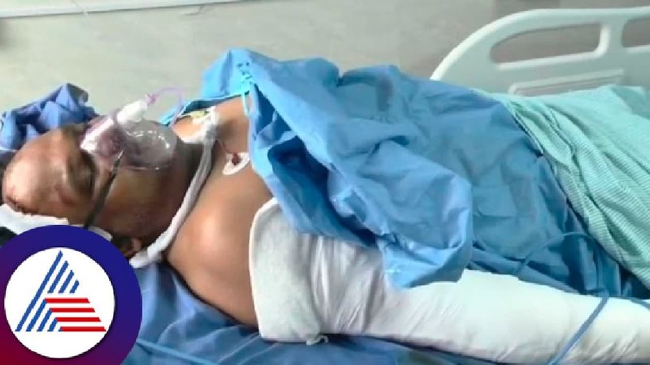 ಮನೆ ಕರೆಂಟ್ ಬಿಲ್ ಹೆಚ್ಚಿಗೆ ಬಂದಿದ್ದಕ್ಕೆ ಕೈ ಕಾಲು ಮುರಿದುಕೊಂಡು ಆಸ್ಪತ್ರೆ ಸೇರಿದ ವ್ಯಕ್ತಿ! 