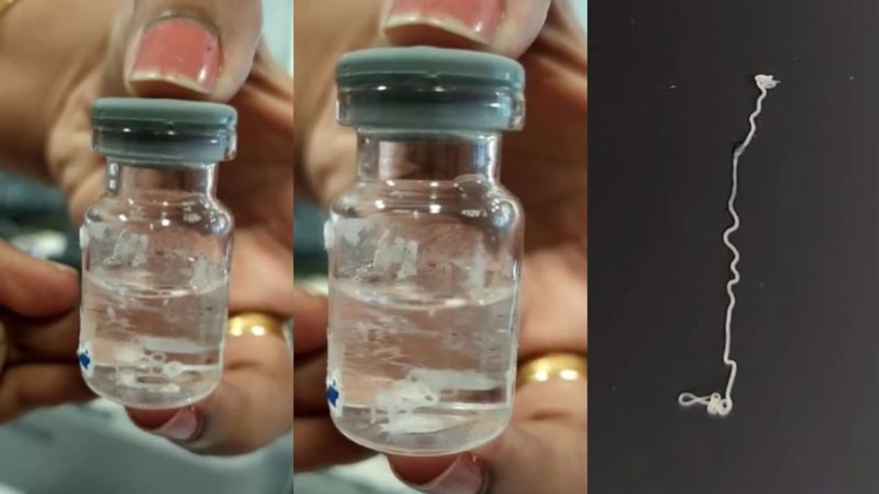 തടിപ്പും ചുവപ്പും വേദനയും, ആലുവയിൽ 39കാരിയുടെ കണ്ണില്‍ നിന്ന് ജീവനോടെ പുറത്തെടുത്തത് 15 സെ.മീ. നീളമുള്ള വിര!