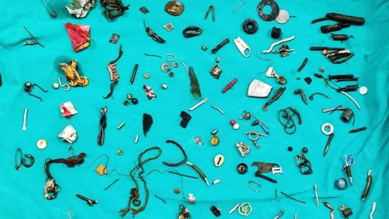 நோயாளி வயிற்றுக்குள் இயர்போன்கள்.. இரும்பு பொருட்கள்.. ஆடிப்போன மருத்துவர்கள் பதறவைக்கும் சம்பவம் நோயாளி வயிற்றுக்குள் இயர்போன்கள்.. இரும்பு பொருட்கள்.. ஆடிப்போன மருத்துவர்கள் பதறவைக்கும் சம்பவம்