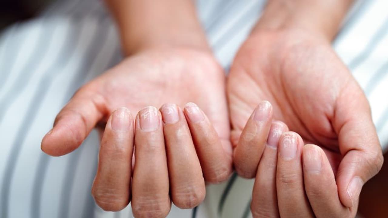 ശരീരത്തിൽ ഇരുമ്പിന്‍റെ കുറവുണ്ടോ? എങ്കില്‍, നിങ്ങള്‍ ചെയ്യേണ്ടത്... 