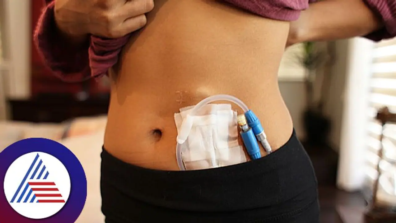 ಅಕ್ಕನಿಗೆ ಕಿಡ್ನಿ ಕೊಡಲು ನಿರಾಕರಿಸಿದ ತಂಗಿ.. ಚರ್ಚೆಯಲ್ಲಿದೆ ಕಾರಣ! ಅಕ್ಕನಿಗೆ ಕಿಡ್ನಿ ಕೊಡಲು ನಿರಾಕರಿಸಿದ ತಂಗಿ.. ಚರ್ಚೆಯಲ್ಲಿದೆ ಕಾರಣ!