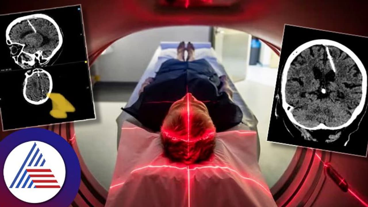 ಮೆದುಳಲ್ಲಿ ಸೂಜಿ ಇಟ್ಕೊಂಡೇ 80 ವರ್ಷ ಬದುಕಿದ್ದಾಳಂತೆ ಈ ಮಹಿಳೆ! ಮೆದುಳಲ್ಲಿ ಸೂಜಿ ಇಟ್ಕೊಂಡೇ 80 ವರ್ಷ ಬದುಕಿದ್ದಾಳಂತೆ ಈ ಮಹಿಳೆ!