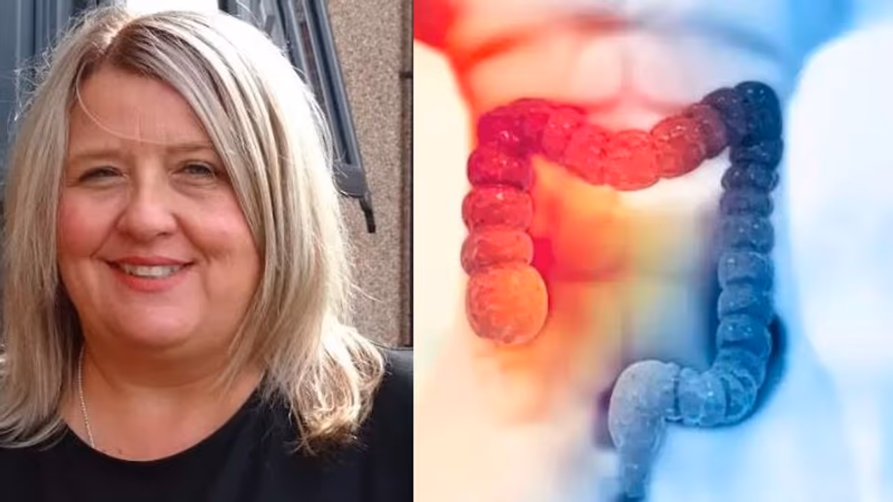 ವೈದ್ಯಕೀಯ ಅಚ್ಚರಿ: 3ನೇ ಹಂತದ ಕರುಳಿನ ಕ್ಯಾನ್ಸರ್‌ನಿಂದ ಬಳಲುತ್ತಿದ್ದ ಮಹಿಳೆ ಸಂಪೂರ್ಣ ಗುಣಮುಖ