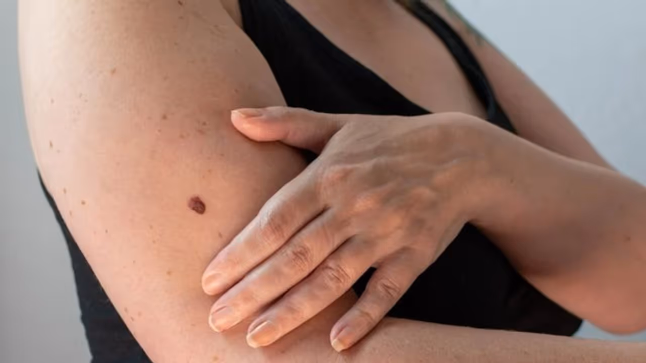 ചര്മ്മത്തിലും തലയോട്ടിയിലും കാണുന്ന ഈ സൂചനകളെ നിസാരമായി കാണരുത്... ചര്മ്മത്തിലും തലയോട്ടിയിലും കാണുന്ന ഈ സൂചനകളെ നിസാരമായി കാണരുത്...