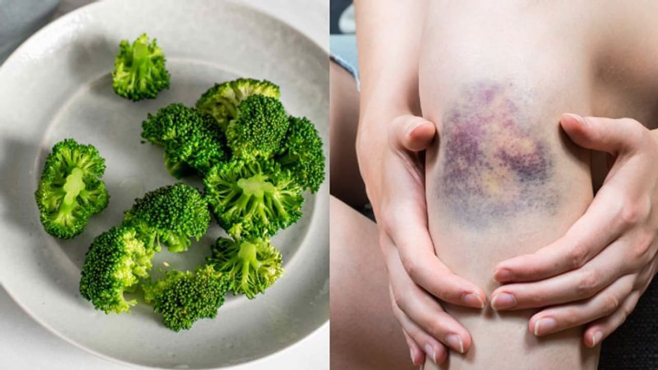 വിറ്റാമിന്‍ കെയുടെ കുറവ്; ഡയറ്റില്‍ ഉള്‍പ്പെടുത്താം ഈ പത്ത് ഭക്ഷണങ്ങള്‍...