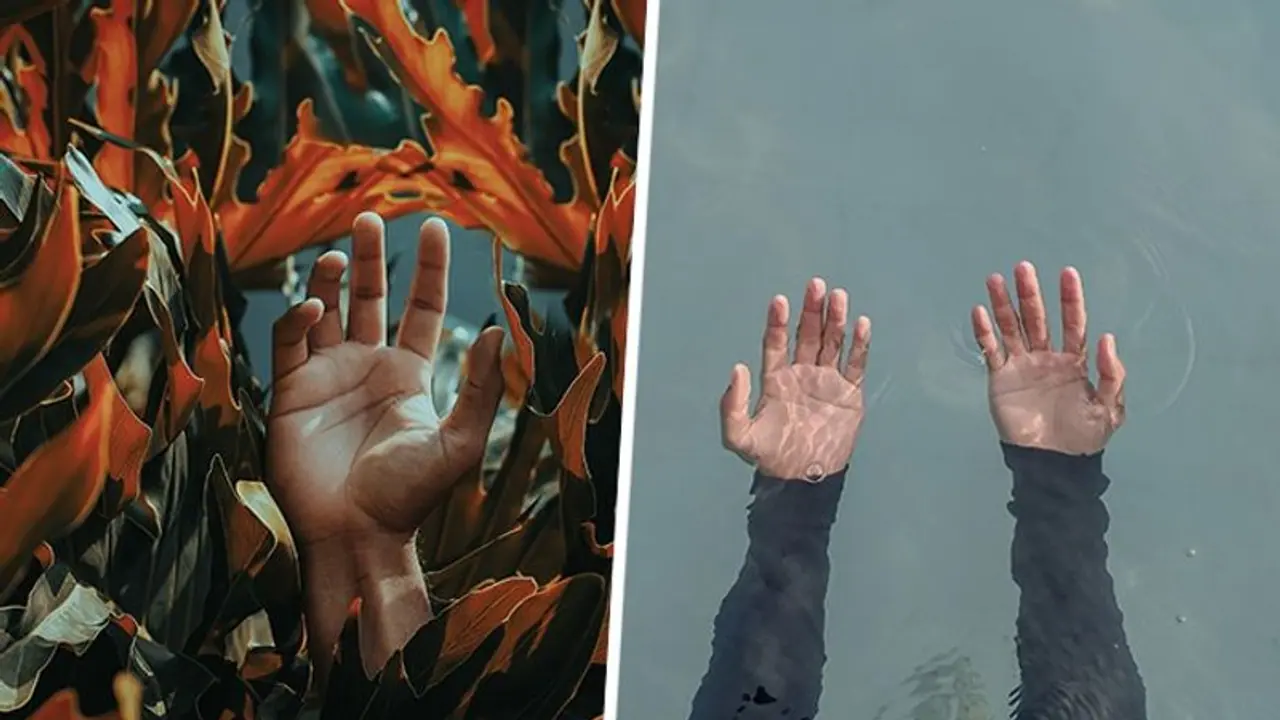 Sweaty palms no more: 7 effective ways to manage excessive hand perspiration