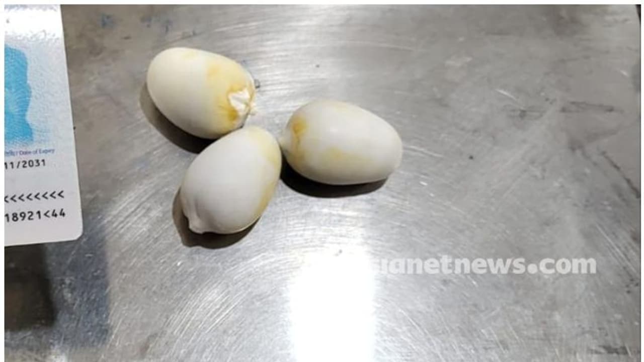 കരിപ്പൂർ വിമാനത്താവളത്തിൽ വീണ്ടും സ്വര്ണവേട്ട; ശരീരത്തില് ഒളിപ്പിച്ച് കടത്താന് ശ്രമിച്ചയാള് പിടിയില് കരിപ്പൂർ വിമാനത്താവളത്തിൽ വീണ്ടും സ്വര്ണവേട്ട; ശരീരത്തില് ഒളിപ്പിച്ച് കടത്താന് ശ്രമിച്ചയാള് പിടിയില്