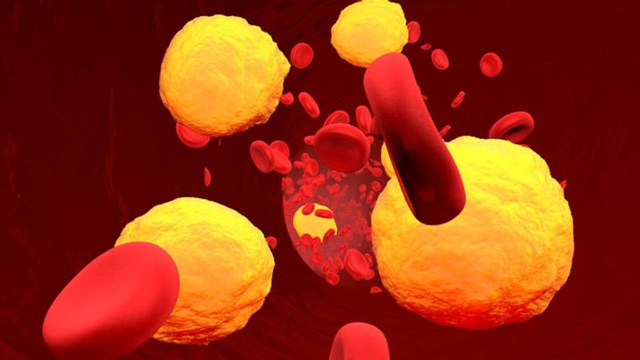 കൊളസ്ട്രോള് കുറയ്ക്കാന് ദിവസവും ഈ ഒരൊറ്റ ഫ്രൂട്ട് കഴിക്കൂ; അറിയാം ഗുണങ്ങള്... കൊളസ്ട്രോള് കുറയ്ക്കാന് ദിവസവും ഈ ഒരൊറ്റ ഫ്രൂട്ട് കഴിക്കൂ; അറിയാം ഗുണങ്ങള്...