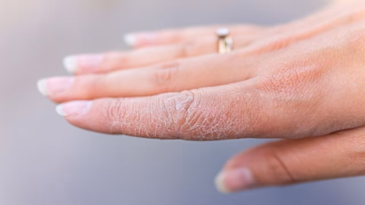 വരണ്ട ചര്മ്മം മാറാന് വീട്ടില് പരീക്ഷിക്കാം ഇക്കാര്യങ്ങള്... വരണ്ട ചര്മ്മം മാറാന് വീട്ടില് പരീക്ഷിക്കാം ഇക്കാര്യങ്ങള്...