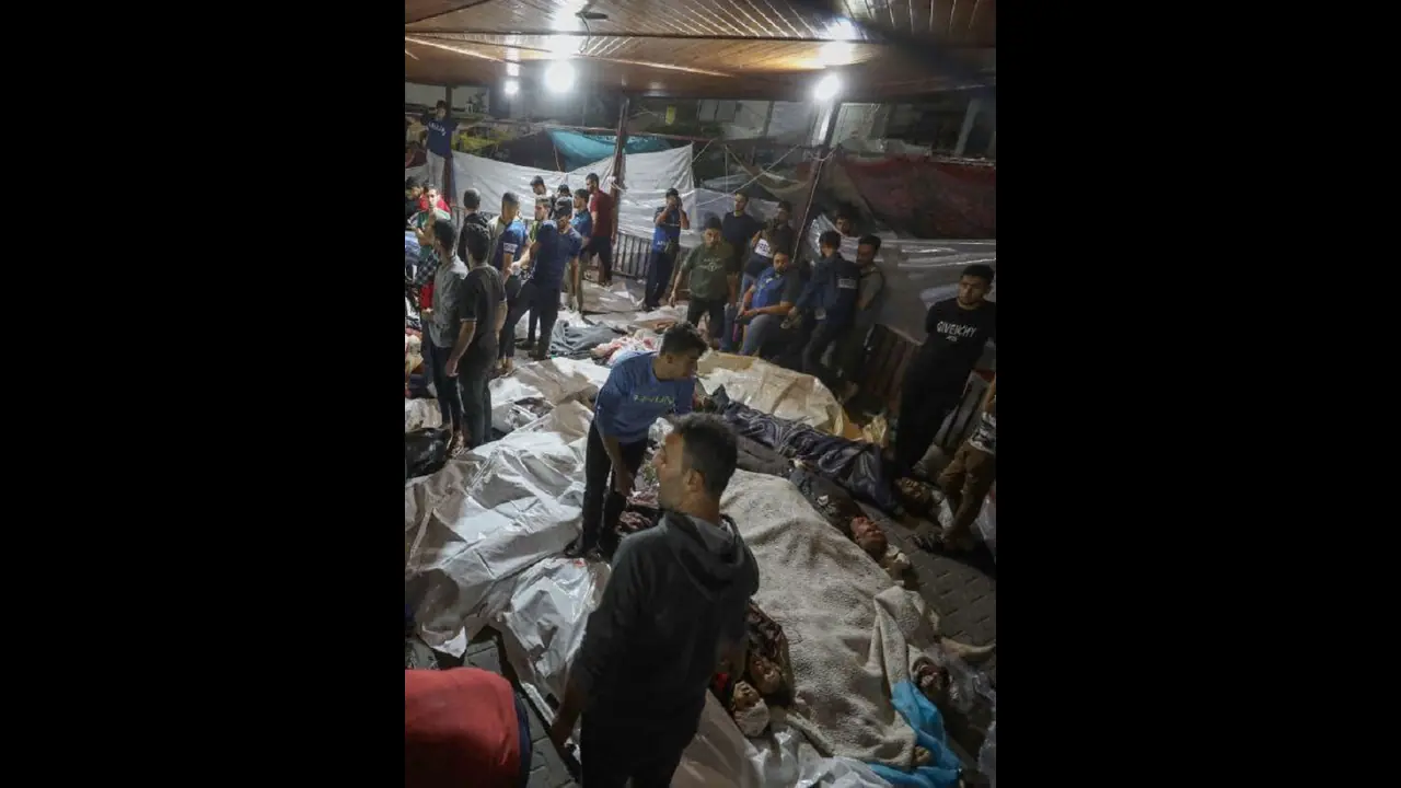 ಗಾಜಾದಲ್ಲಿ ಅನಸ್ತೇಶಿಯಾ ಇಲ್ಲದೇ ಶಸ್ತ್ರಚಿಕಿತ್ಸೆ: ಗಾಯಾಳುಗಳ ಉಳಿಸಲು ವೈದ್ಯರ ಹರಸಾಹಸ ಗಾಜಾದಲ್ಲಿ ಅನಸ್ತೇಶಿಯಾ ಇಲ್ಲದೇ ಶಸ್ತ್ರಚಿಕಿತ್ಸೆ: ಗಾಯಾಳುಗಳ ಉಳಿಸಲು ವೈದ್ಯರ ಹರಸಾಹಸ