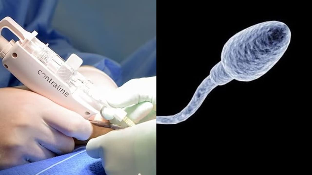 Male Contraceptive: ಪುರುಷರಿಗೆ ಗರ್ಭನಿರೋಧಕ ಇಂಜೆಕ್ಷನ್‌, ಯಶಸ್ವಿ ಪ್ರಯೋಗ ನಡೆಸಿದ ಐಸಿಎಂಆರ್‌