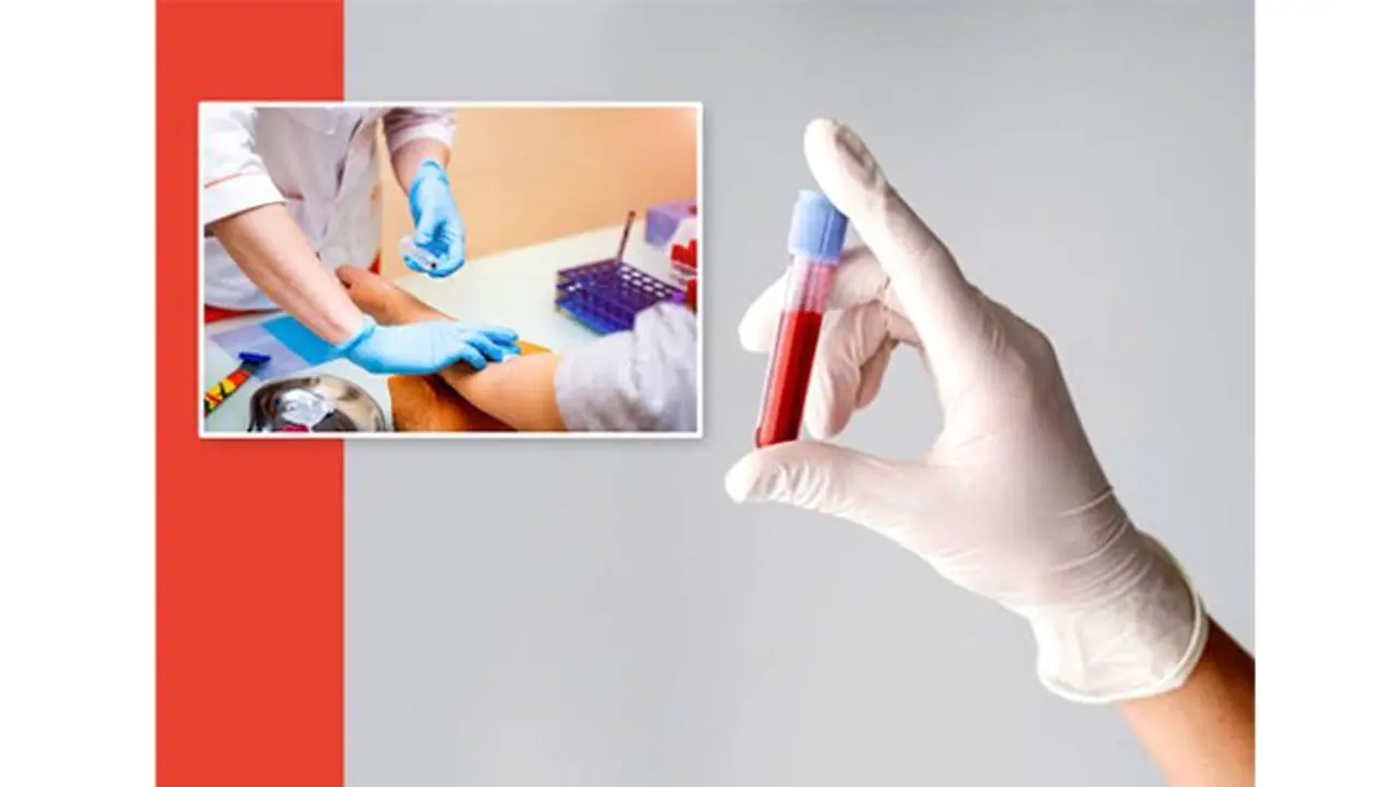 The Advantages of Taking a Blood Test at Home The Advantages of Taking a Blood Test at Home